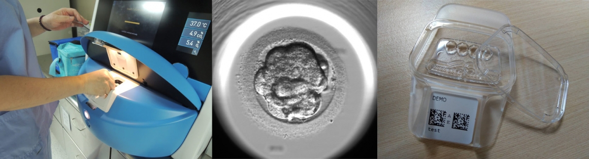 茂盛醫院最新四代試管-四代試管 = 三代試管PGS + 胚胎即時影像監控 + 最新演算法