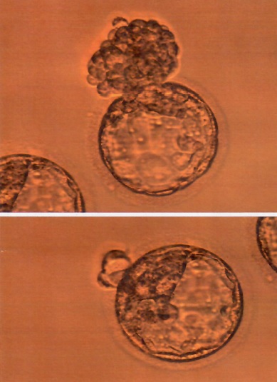 龍鳳胎之胚胎圖