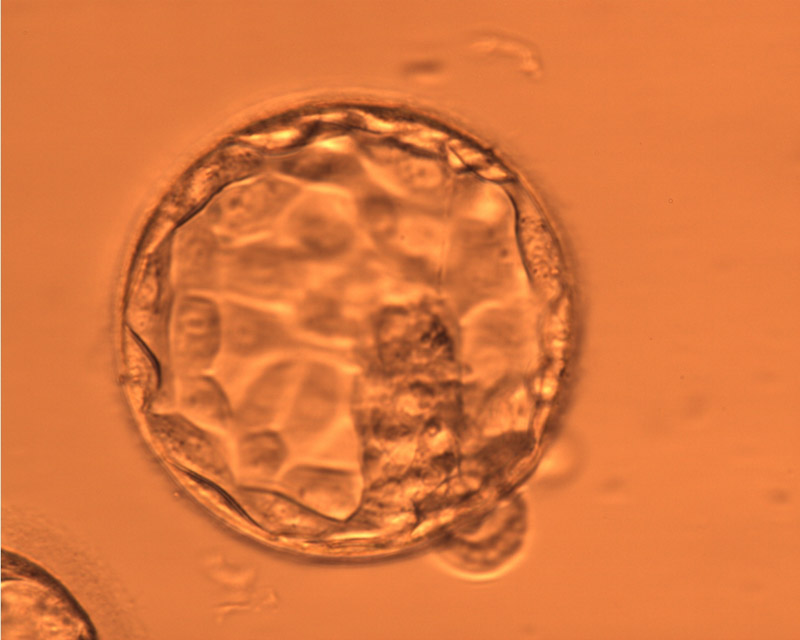 培育至第5天的2顆優質囊胚