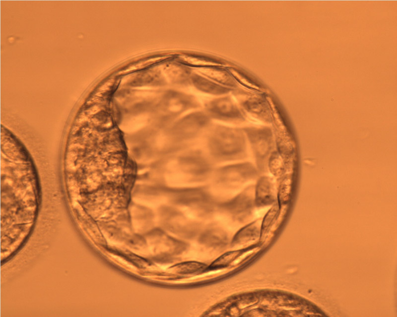 培育至第5天的2顆優質囊胚