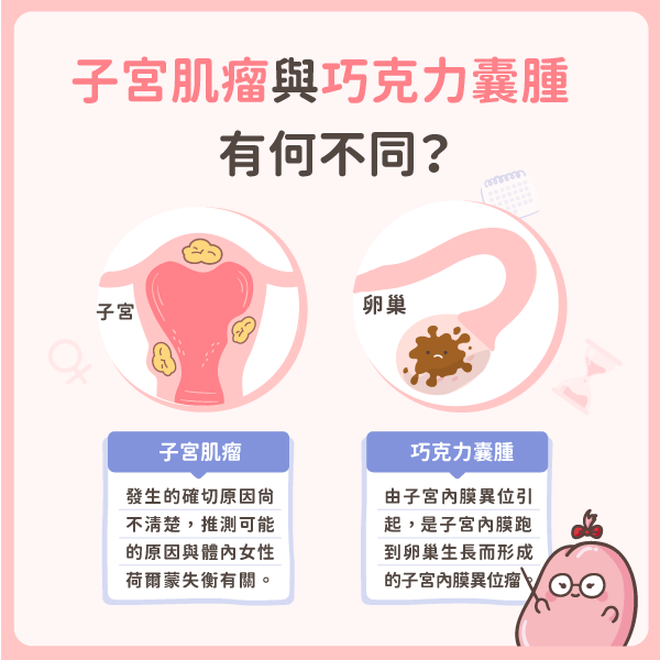 巧克力囊腫與子宮肌瘤的不同