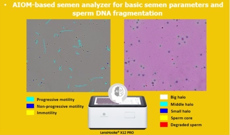 人工智慧光學顯微鏡（AIOM）精液分析儀呈現的精液參數及精蟲DNA碎片程度