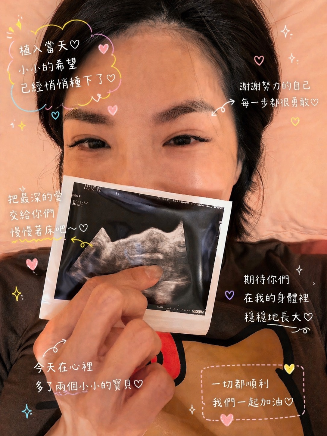 藝人王嫚萱在茂盛醫院植入胚胎