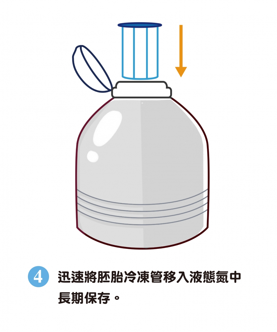 玻璃化冷凍步驟四：迅速將胚胎冷凍管移入液態氮中長期保存