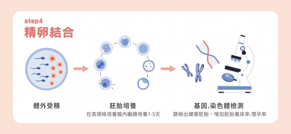 凍胚流程步驟4：精卵結合