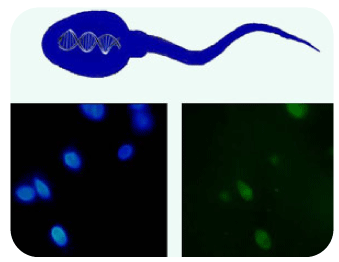 精蟲DNA碎片化檢測