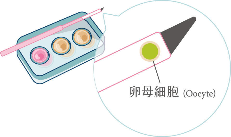 新型凍存技術圖示-05 新型凍存技術圖示-05