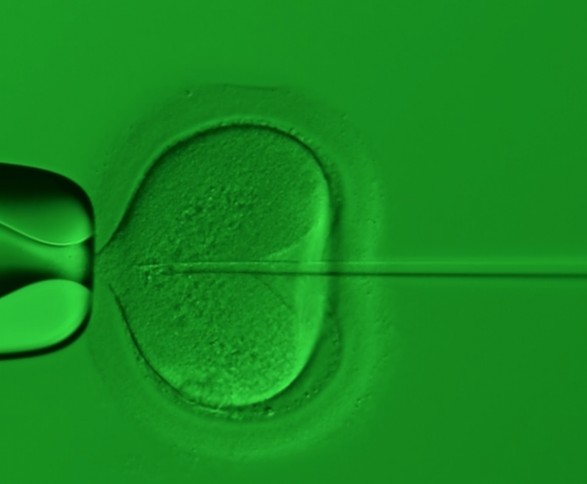 單一精蟲顯微注射有助於非阻塞性無精症患者提高受精率 單一精蟲顯微注射有助於非阻塞性無精症患者提高受精率
