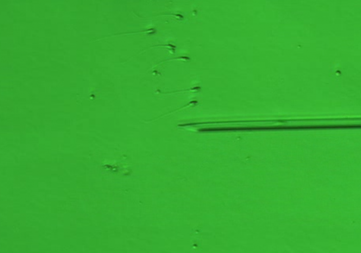 於高倍率顯微鏡下篩選外觀形態良好之精子進行顯微注射 於高倍率顯微鏡下篩選外觀形態良好之精子進行顯微注射