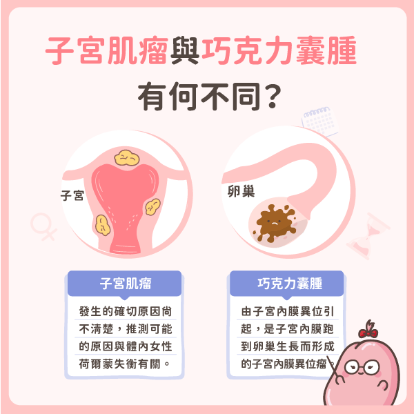 巧克力囊腫與子宮肌瘤的不同 巧克力囊腫與子宮肌瘤的不同