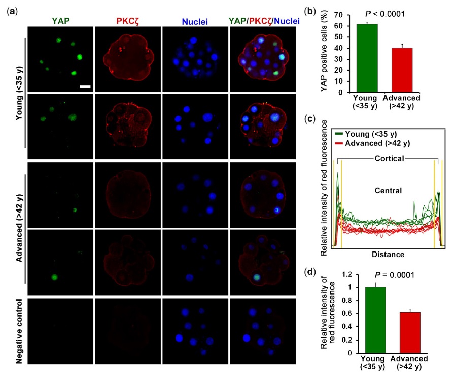 圖三、為兩個不同年齡群Yes-associated protein (YAP) 和 protein kinase C-ζ (PKCζ)的螢光表現圖。(a)螢光表現強度,(b)-(d)為量化圖 圖三、為兩個不同年齡群Yes-associated protein (YAP) 和 protein kinase C-ζ (PKCζ)的螢光表現圖。(a)螢光表現強度,(b)-(d)為量化圖