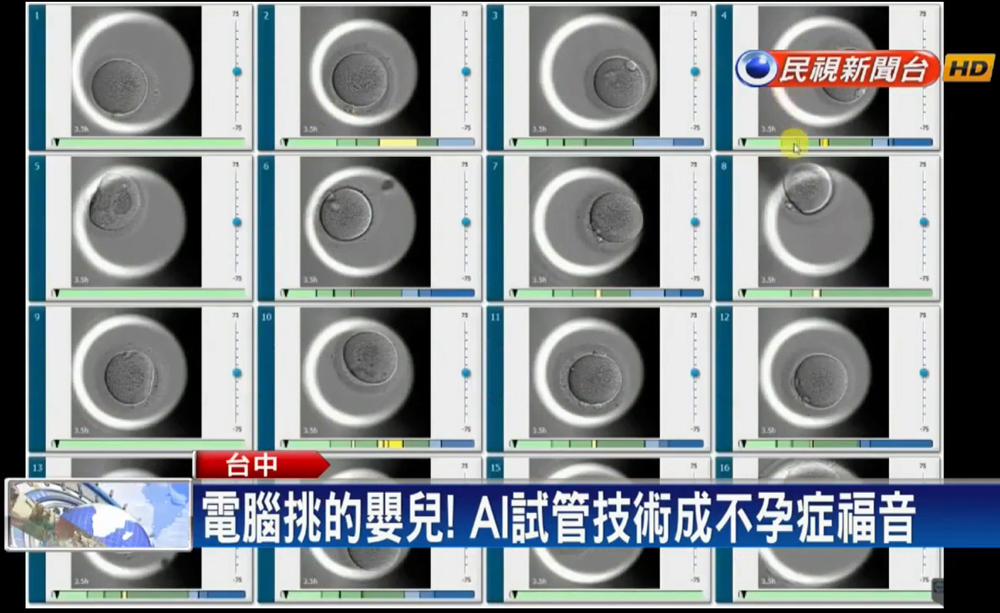 茂盛醫院最新四代試管-電腦挑的嬰兒 AI技術成不孕症福音