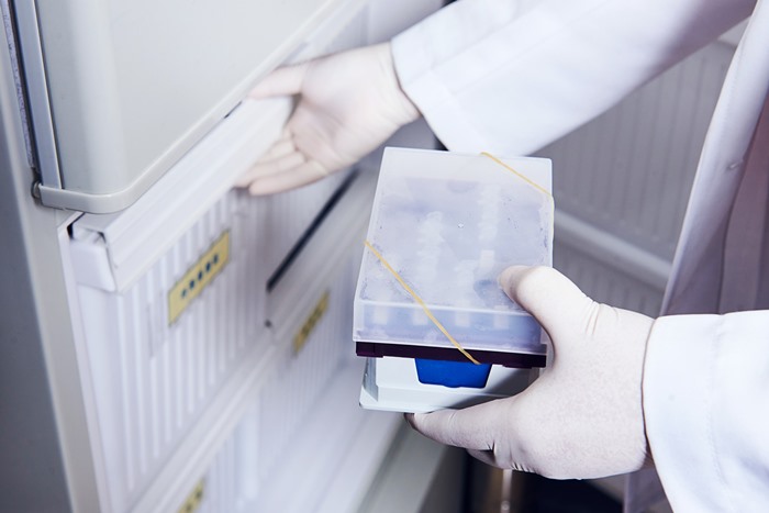 檢體保存 檢體保存