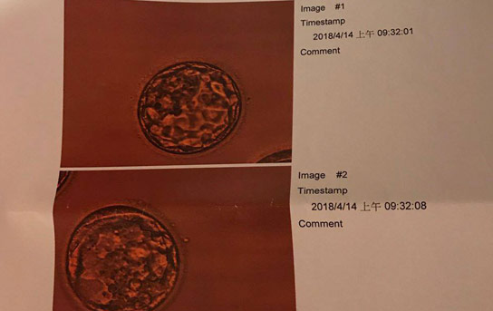 菲律賓愛 菲律賓愛